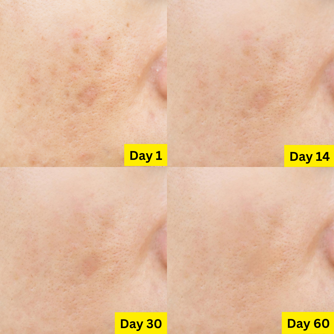 💫 PETAL PEEL 20% Resurfacing Jelly Serum