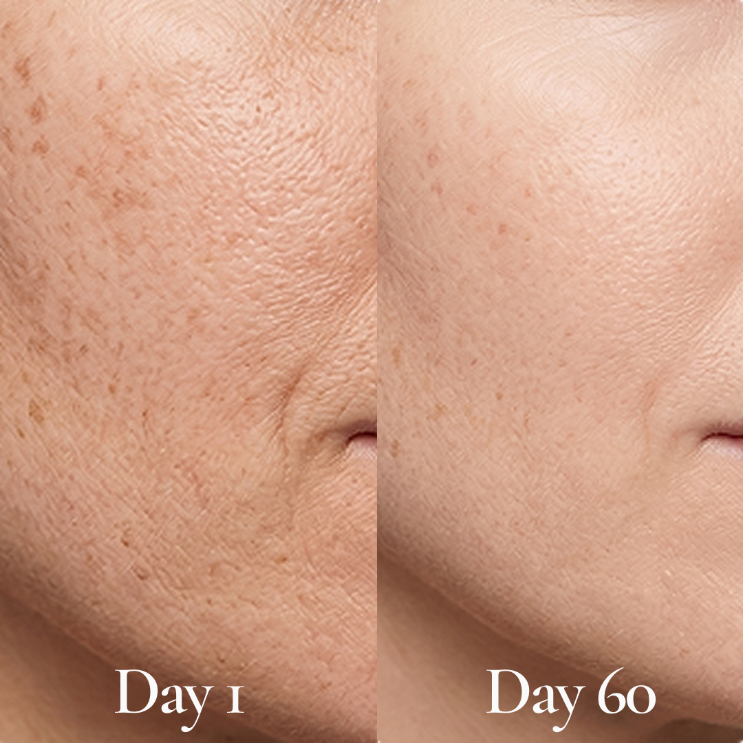 The Evening Glow + Texture Fix