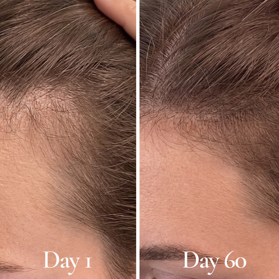 Root Bloom All Natural Hair Growth Serum