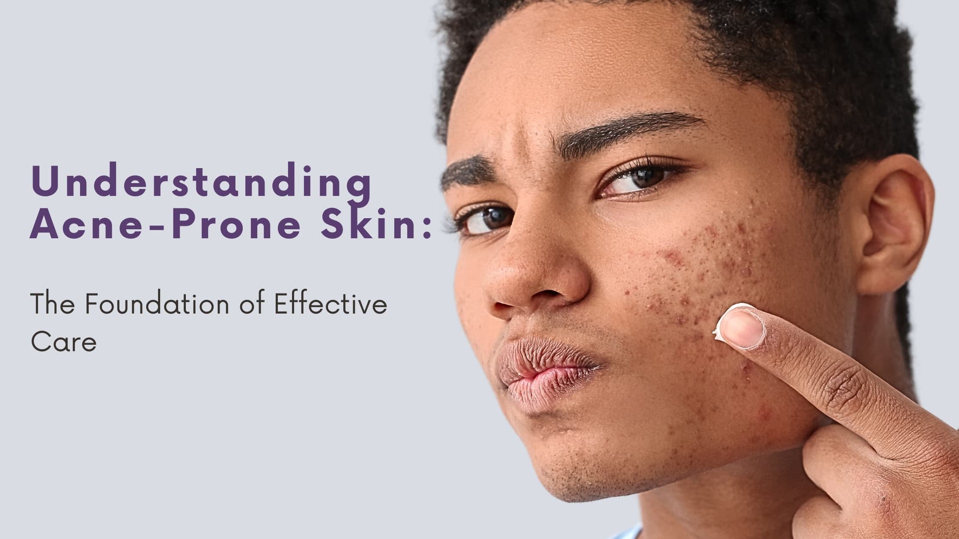 Acne Prone Skin Tips Meet Acne Prone Safe Skincare Must Haves