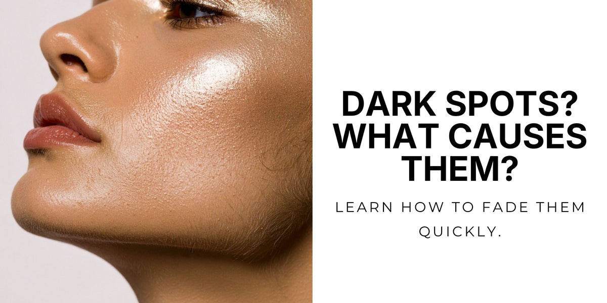 Dark Spots: What Causes Them & How to Fade Them Safely Without Damaging Your Skin Barrier