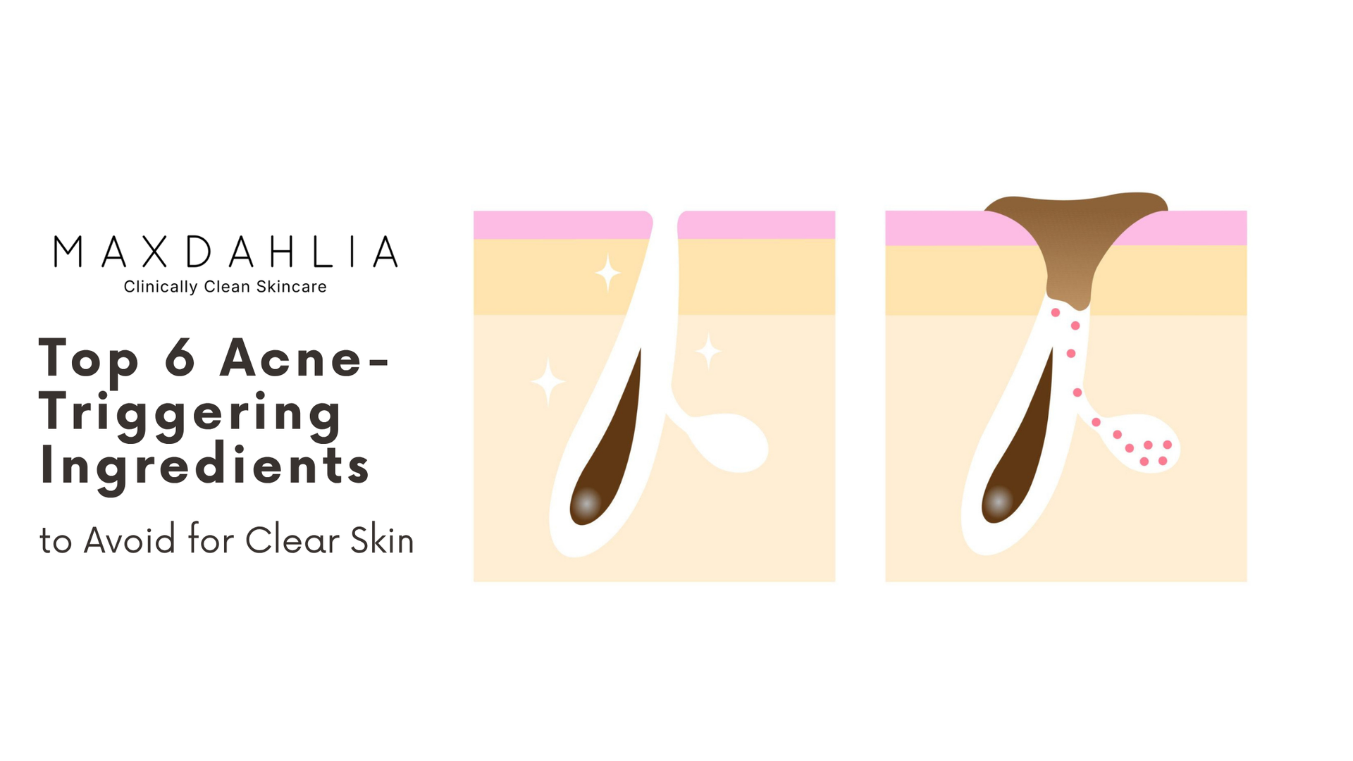 Pore Clogging Ingredients
