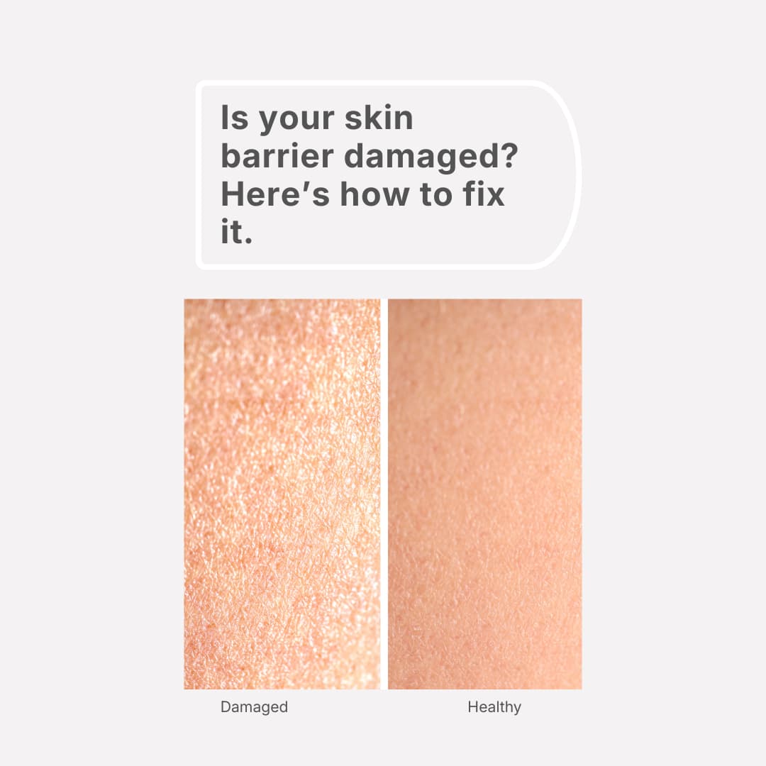 skin barrier repair