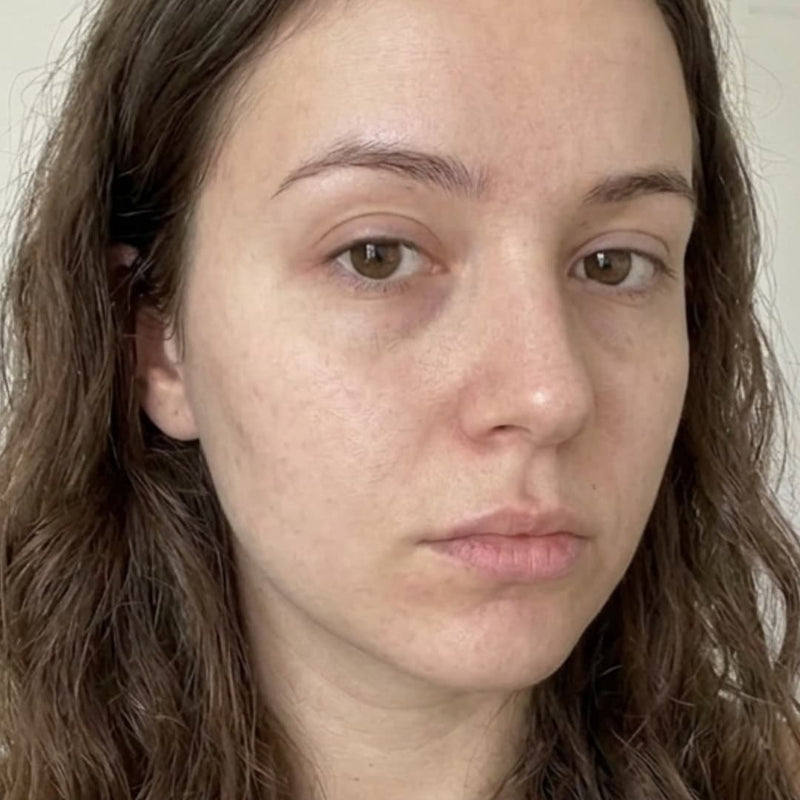 Day 1