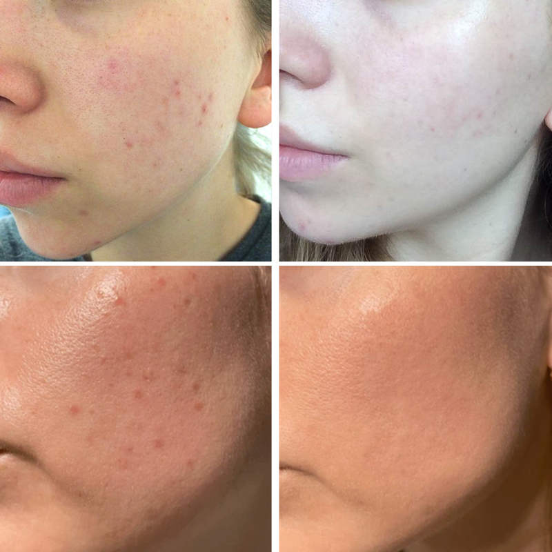 Petal Peel 20% AHA Night Resurfacing Jelly Serum