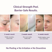 Petal Peel 20% AHA Night Resurfacing Jelly Serum