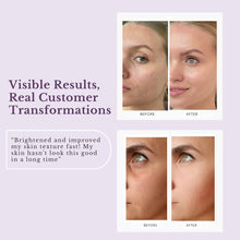 Petal Peel 20% AHA Night Resurfacing Jelly Serum