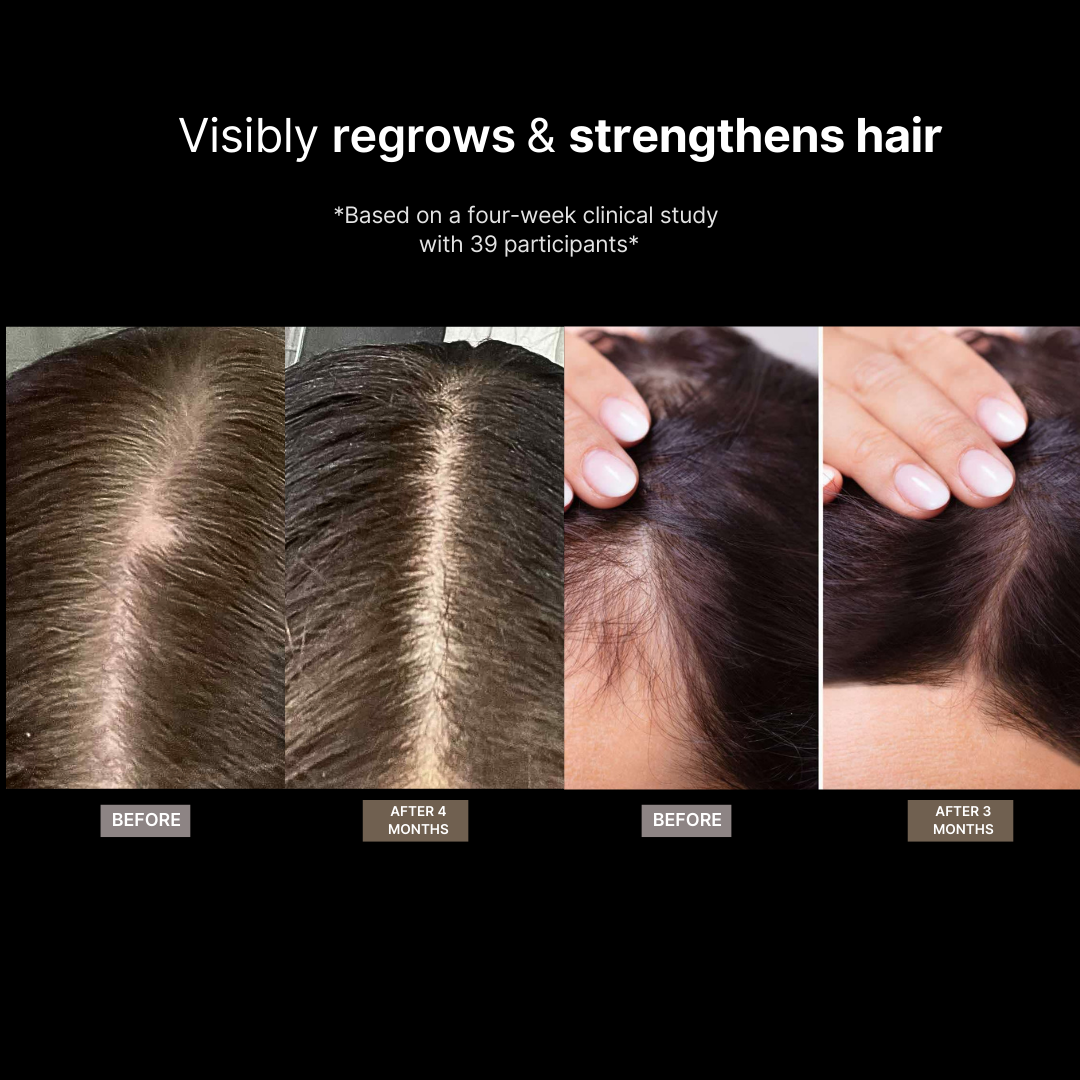 Root Bloom All Natural Hair Growth Serum