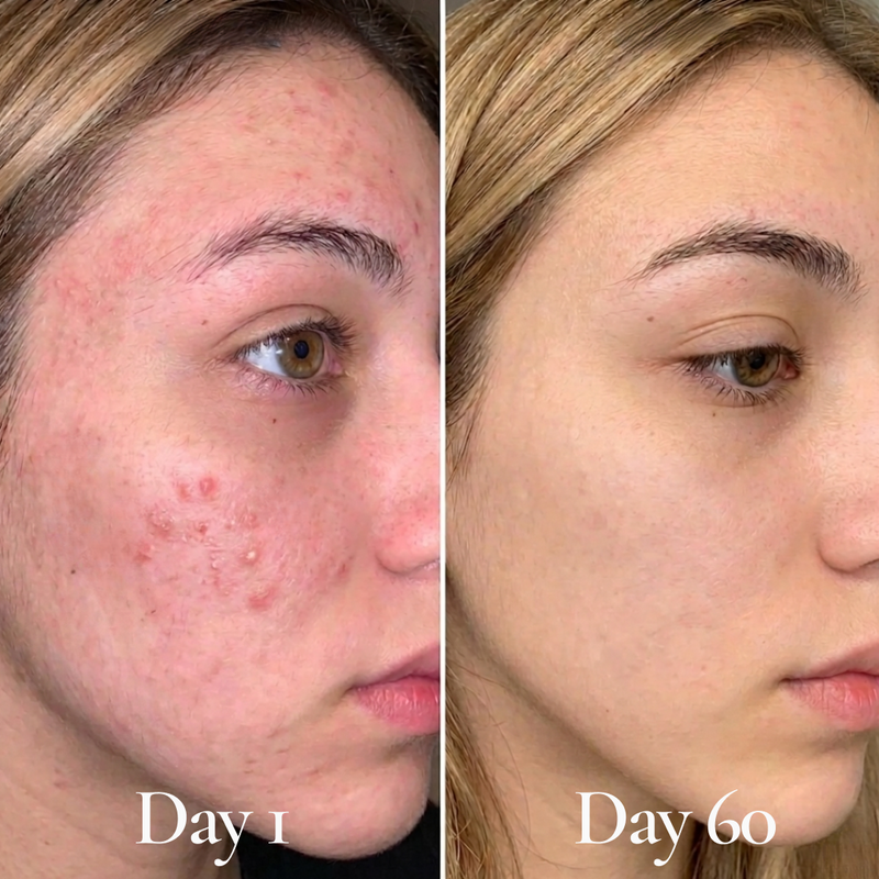 HydroFlora Barrier Repair Oil Gel