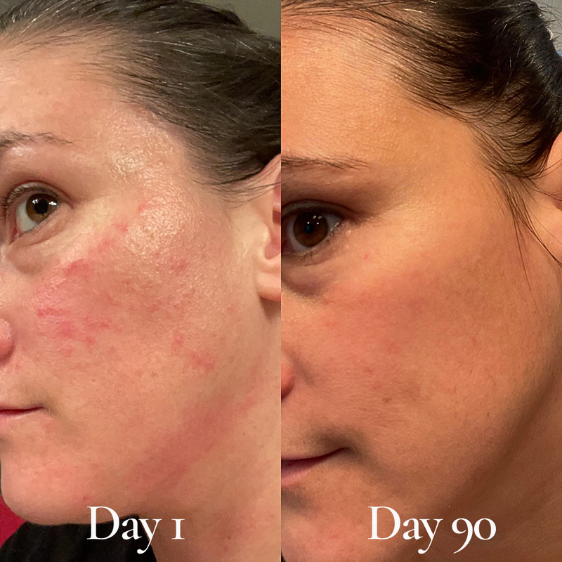 HydroFlora Barrier Repair Oil Gel