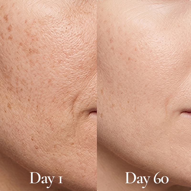 The Evening Glow + Texture Fix