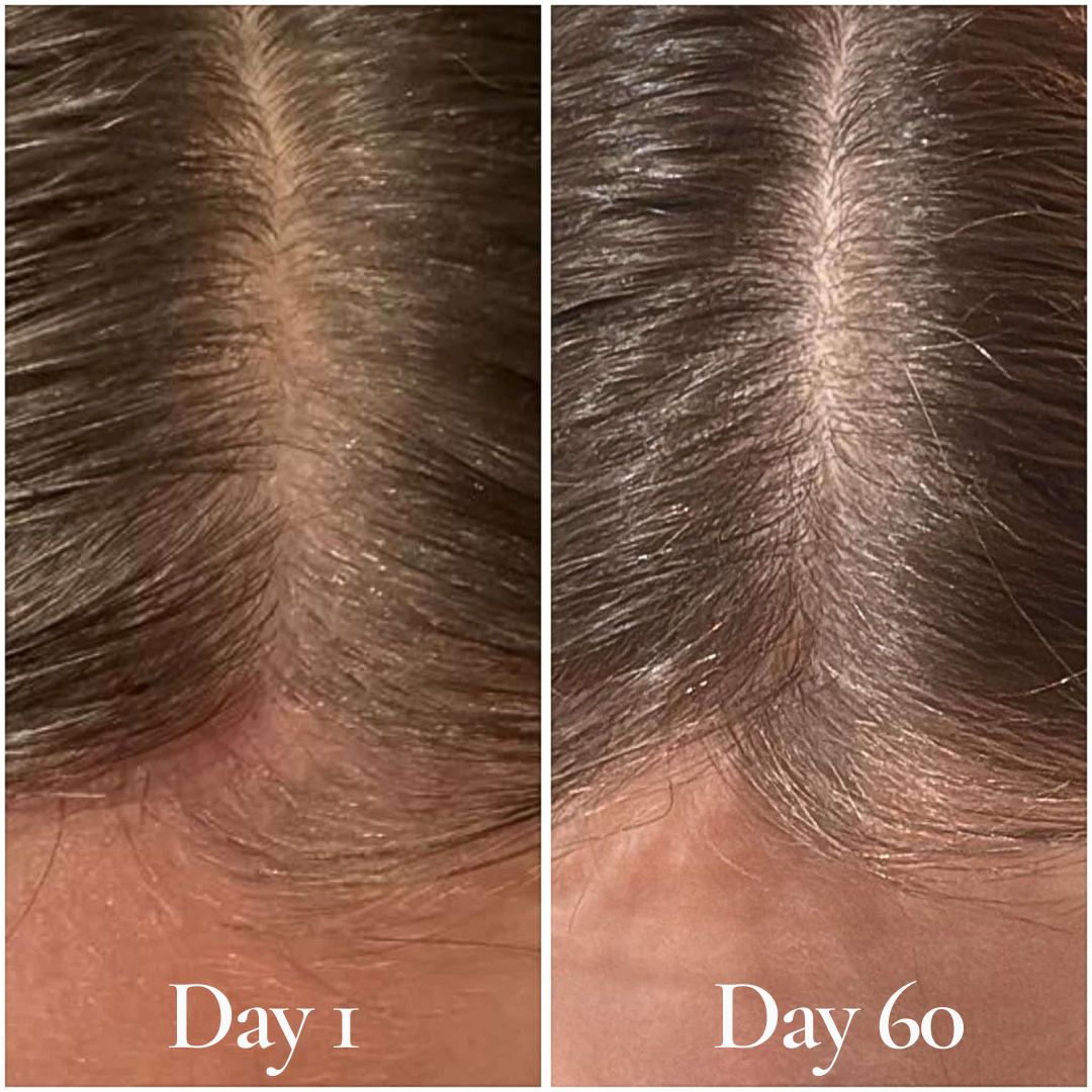 Root Bloom All Natural Hair Growth Serum