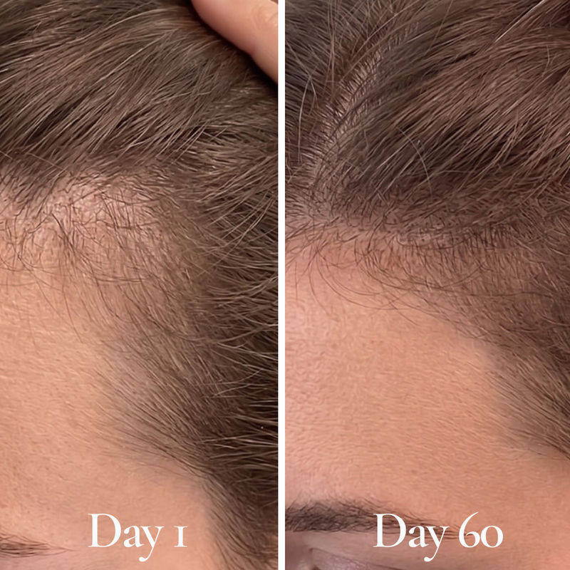 Root Bloom All Natural Hair Growth Serum