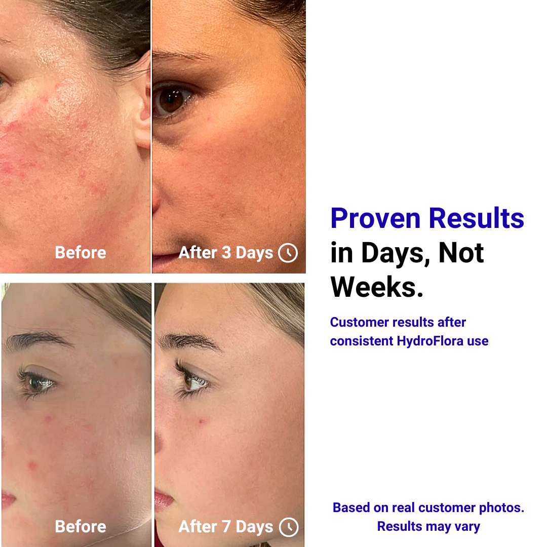 HydroFlora Barrier Repair Oil Gel