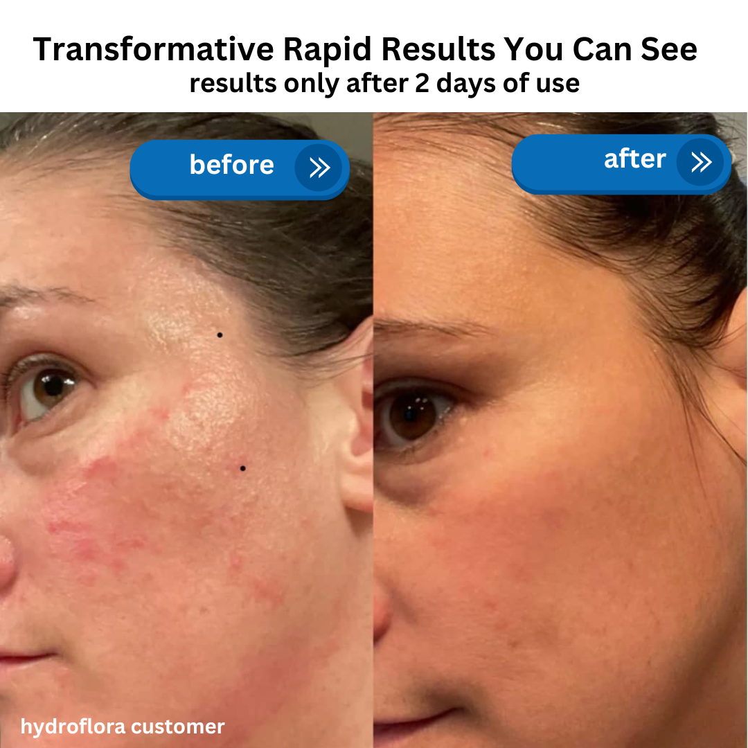 HydroFlora Barrier Repair Oil Gel