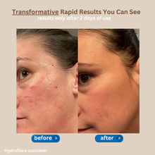 HydroFlora Barrier Repair Oil Gel